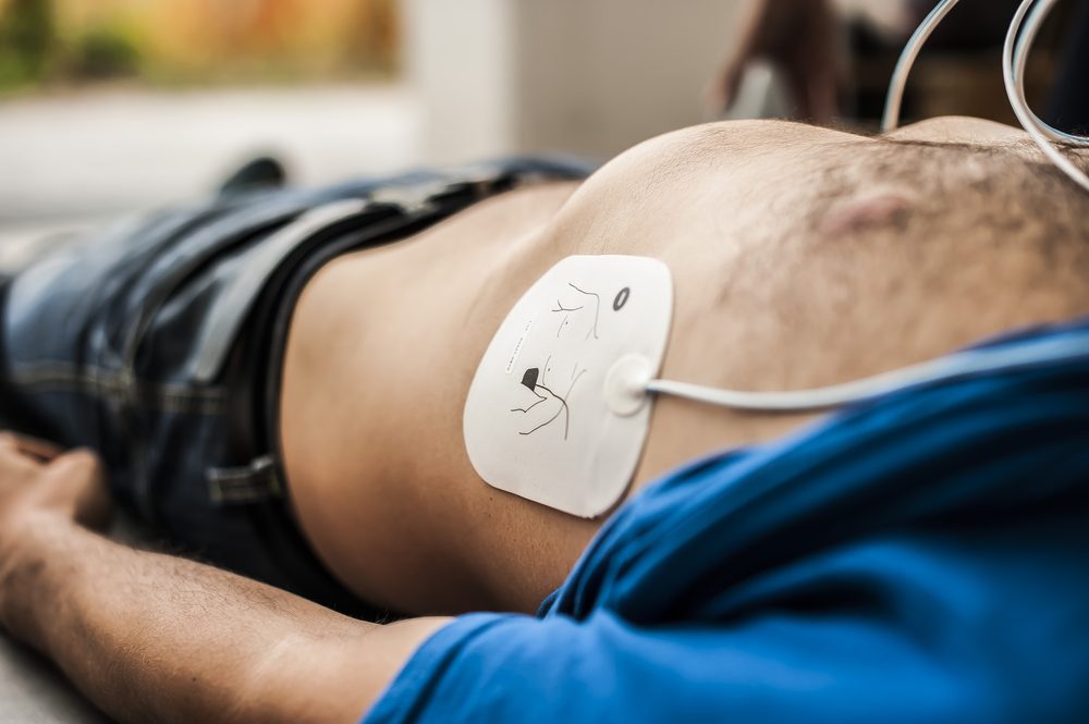 Cardiac Arrest - Deposit Photos