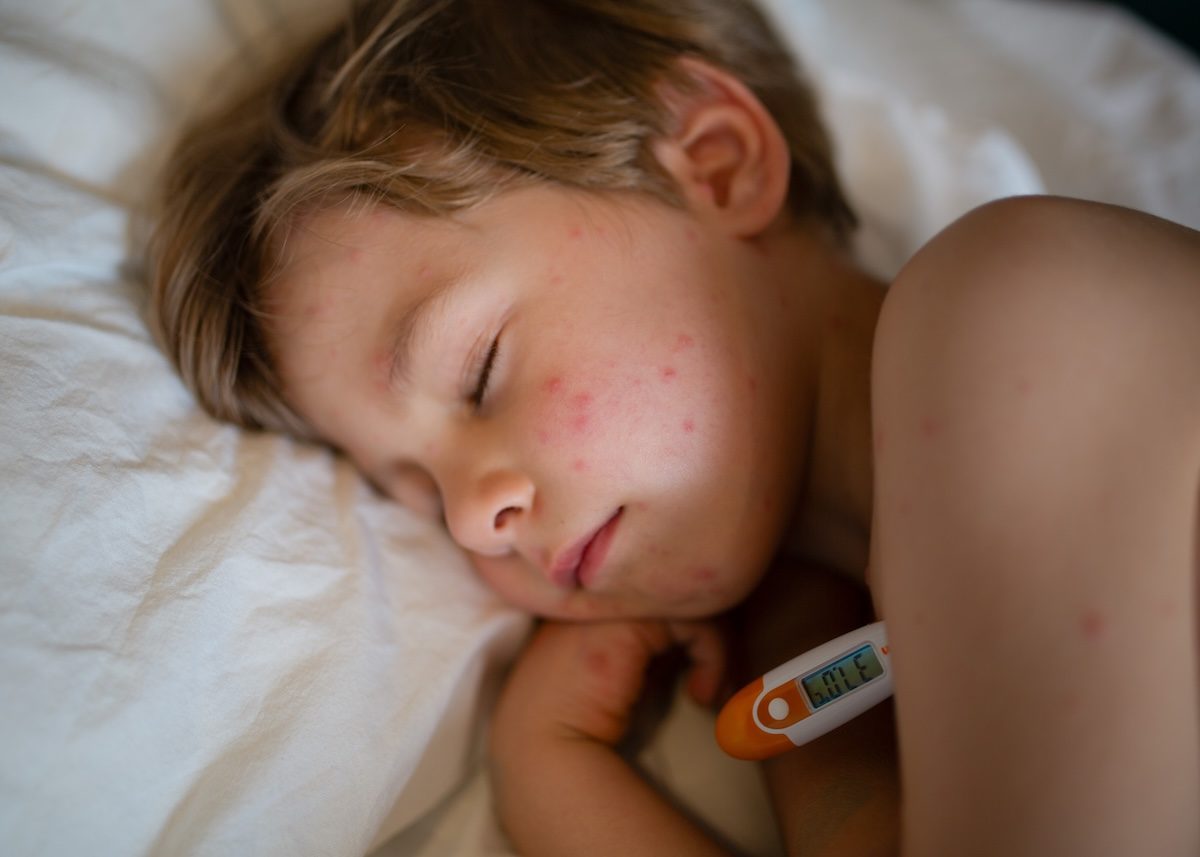 Unwell child with sepsis